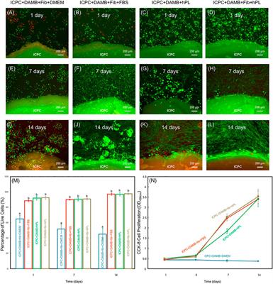 Novel injectable calcium phosphate scaffold with human periodontal ligament stem cell encapsulation in microbeads for bone regeneration